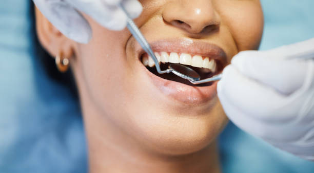 Best Emergency Root Canal Treatment in Holstein, IA